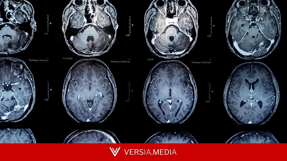 Brain tumors: New vaccine offers patients hope for more time