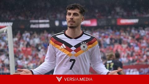 Germany beat USA before World Cup but injuries cast shadow